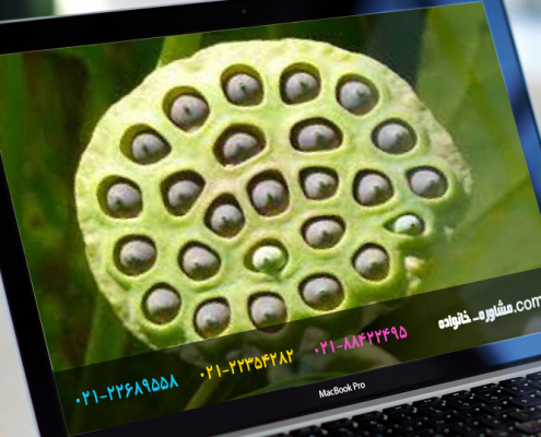 فوبیای سوراخ